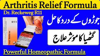Dr. Reckeweg R11 Joint Pain, Arthritis & Sciatica | German Remedy Explained!