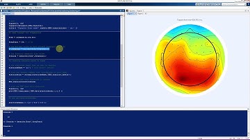 EEG data and indexing in Matlab