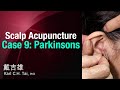 Tais scalp acupuncture  case 9 parkinsons
