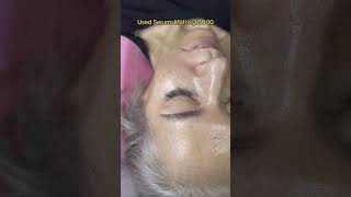 Defy Aging: The Ultimate Matrixyl Serum for Ageless Beauty #fok