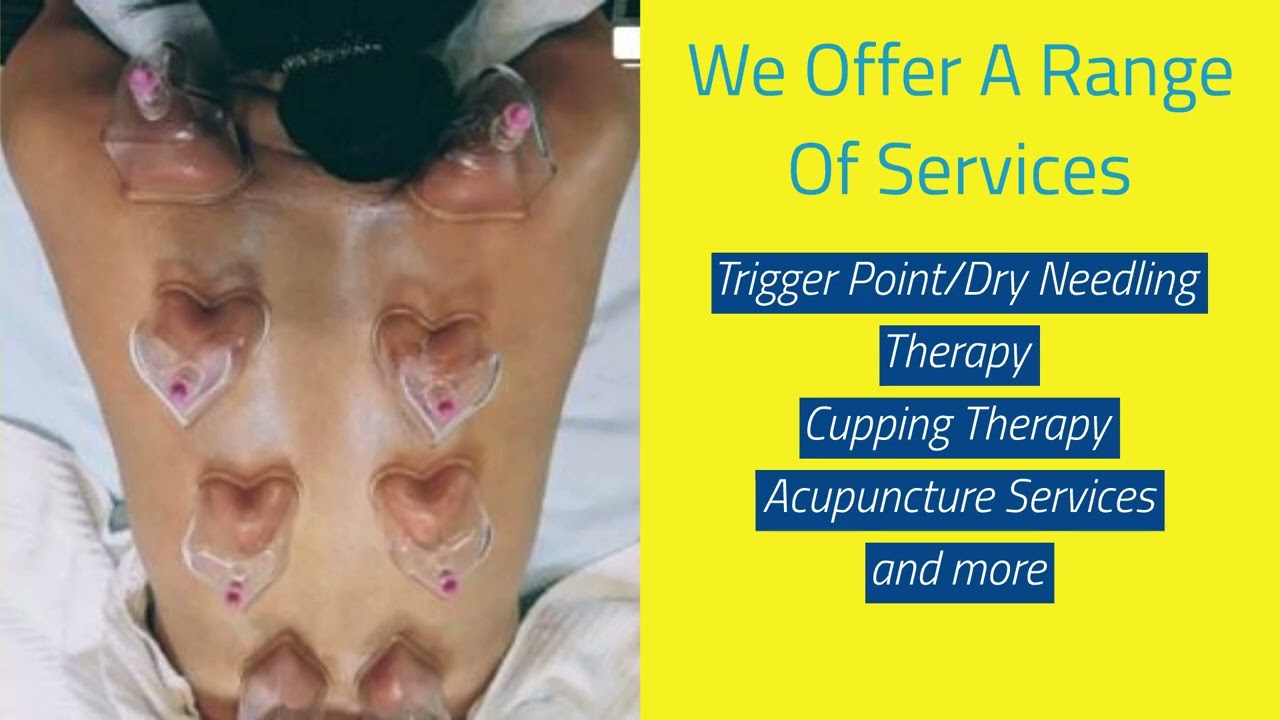 Cupping Therapy NJ | Bergen County Cupping Therapy and Holistic Treatment Services