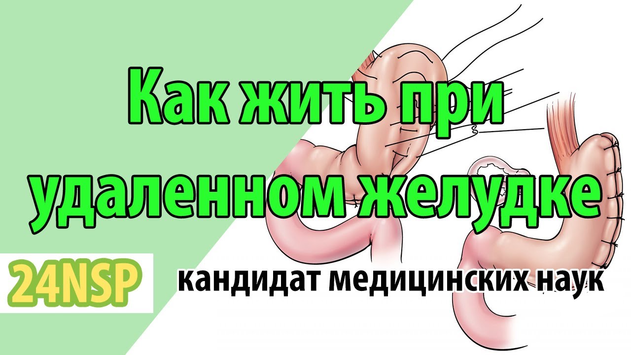 Почему после удаления желудка. Резекция желудка питание. Желудок после резекции. Диета при продольной резекции желудка.