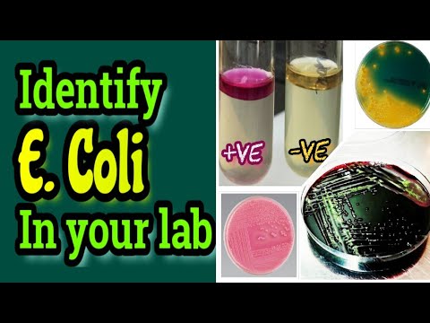 Escherichia coli (E. Coli) identification in pharmaceutical companies and medical laboratories.