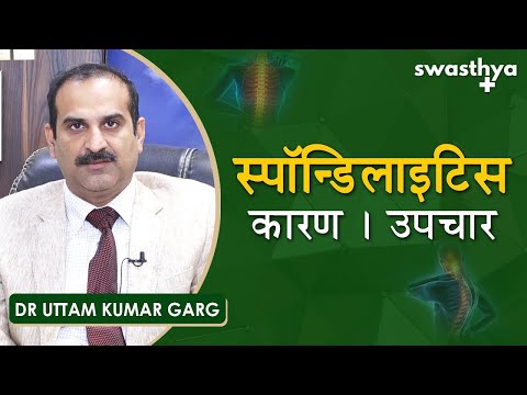 स्पॉन्डिलाइटिस के कारण और उपचार | Dr Uttam Kumar Garg on Causes & Treatment of Spondylitis in Hindi