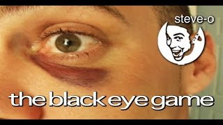 The Black Eye Game - Steve-O