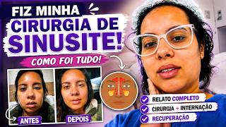 FIZ MINHA CIRURGIA DE SINUSITE! 😱 Como Foi a Cirurgia e a Recuperação?