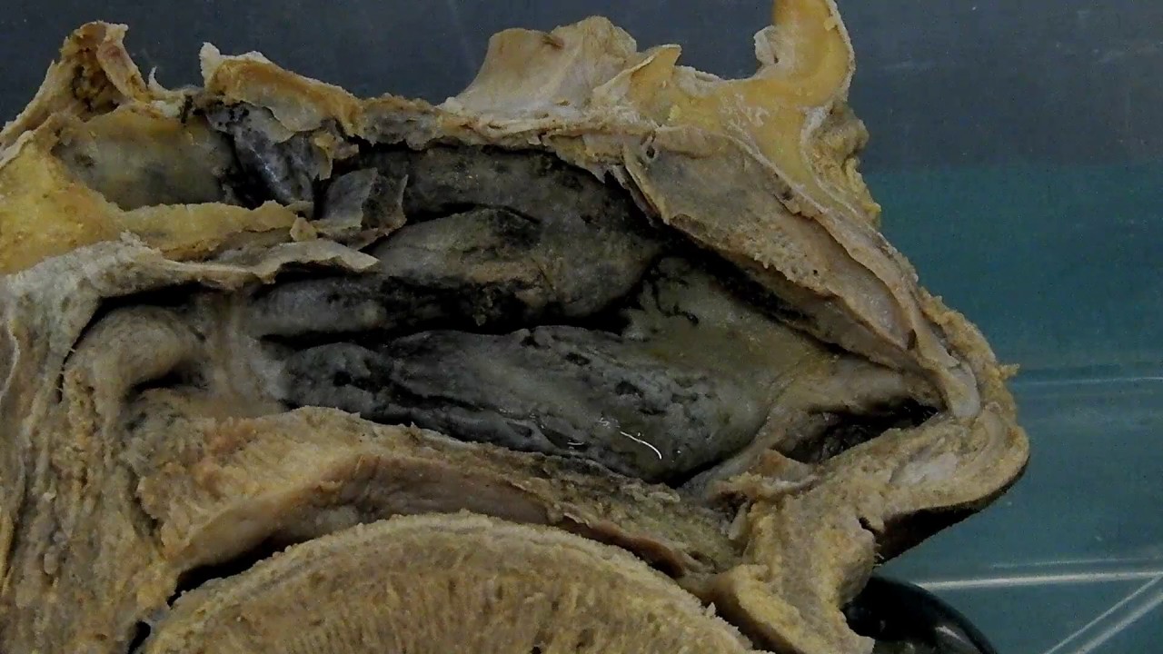 Mid-Sagittal Section of Head and Neck - YouTube