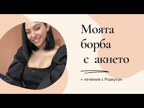 АКНЕ | ЛЕЧЕНИЕ С РОАКУТАН, СТРАНИЧНИ ЕФЕКТИ, ЗАСЛУЖАВА ЛИ СИ | МОЯТ ОПИТ