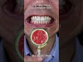 Satisfying Chewing ASMR #Compilation #ASMR #DoctorTristanPeh