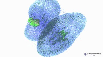 Rat kidneys (ex vivo) - Contrast-enhanced MRI