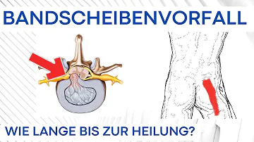 Wie lange Ruhe nach Bandscheibenvorfall?