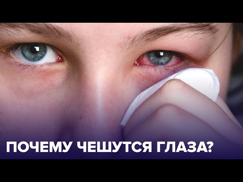 Чешутся ГЛАЗА: возможные ПРИЧИНЫ ЗУДА