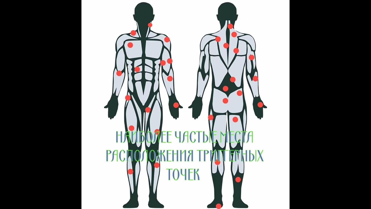 Массаж триггерных точек