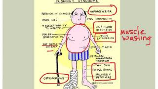 Endocrine Disorders