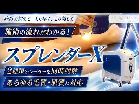 ハイスピード医療脱毛】スプレンダーX施術風景！ - YouTube