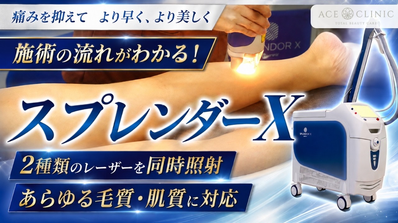 ハイスピード医療脱毛】スプレンダーX施術風景！ - YouTube
