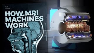 Demystifying MRI: A Deep Dive into Magnetic Resonance Imaging. How does it work?