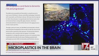 Microplastics in brain: Duke researcher talks about study