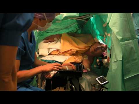 awake craniotomy with singing and talking