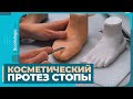 Косметический протез стопы для ребенка