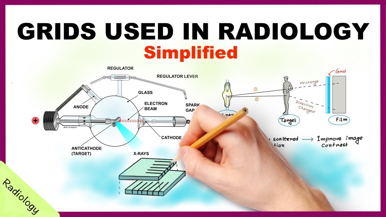 Grids Used In Radiology Simplified Radiology YouTube