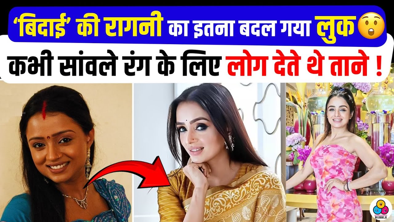 Plastic Surgery के बाद कैसी दिखती है  Serial Bidaai में सीधी-साधी Parul Chauhan.