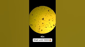 Boiled egg under the microscope #boileggs #boilegg #egg #microscopicworld