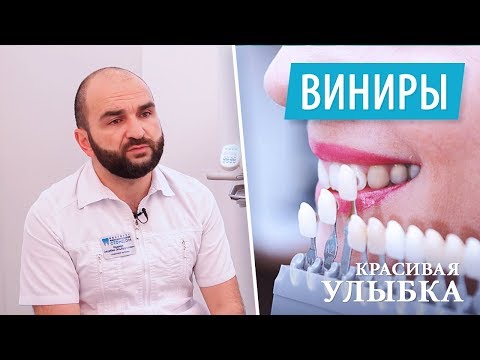 Виниры для зубов - что это такое. Красивые зубы. Установка виниров.