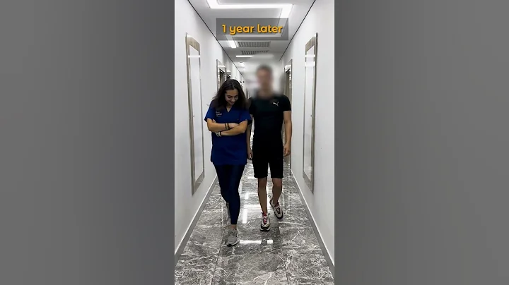 From 170 cm to 178 cm: Leg Lengthening Surgery Recovery Update