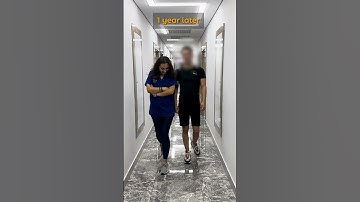 From 170 cm to 178 cm: Leg Lengthening Surgery Recovery Update