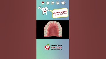 Niềng răng Invisalign hoạt động như thế nào? | #Short