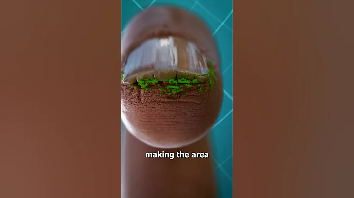 Why You Shouldn't Bite Your Nails 😖