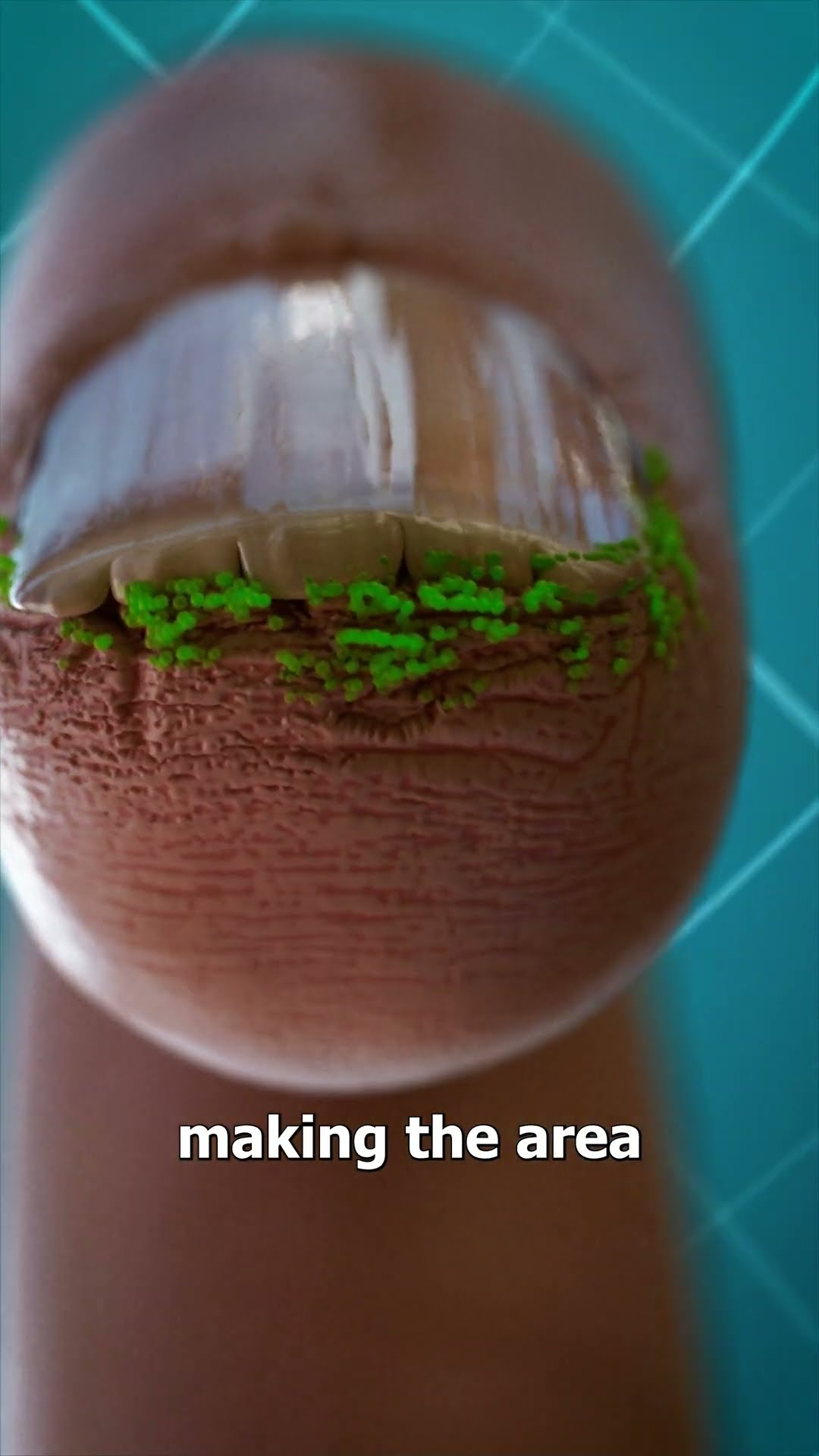 Why You Shouldn't Bite Your Nails ?