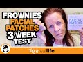 Frownies Facial Patches 3 Week Test - THIS IS REAL LIFE
