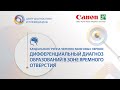 Каудальная группа черепно мозговых нервов: диф. диагноз образований в зоне яремного отверстия