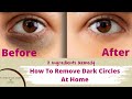 Remove dark circles naturally  home  2 ingredients remedy darkcircles removedarkcircles eyebags