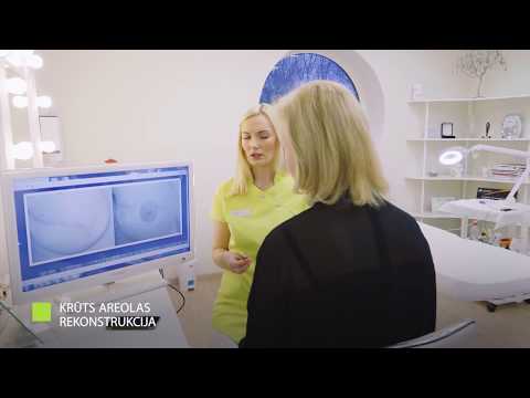 Video: Krūts Vēža ārstēšana - Diagnostika, ārstēšana, Rehabilitācija. Izraēlas Vadošās Klīnikas