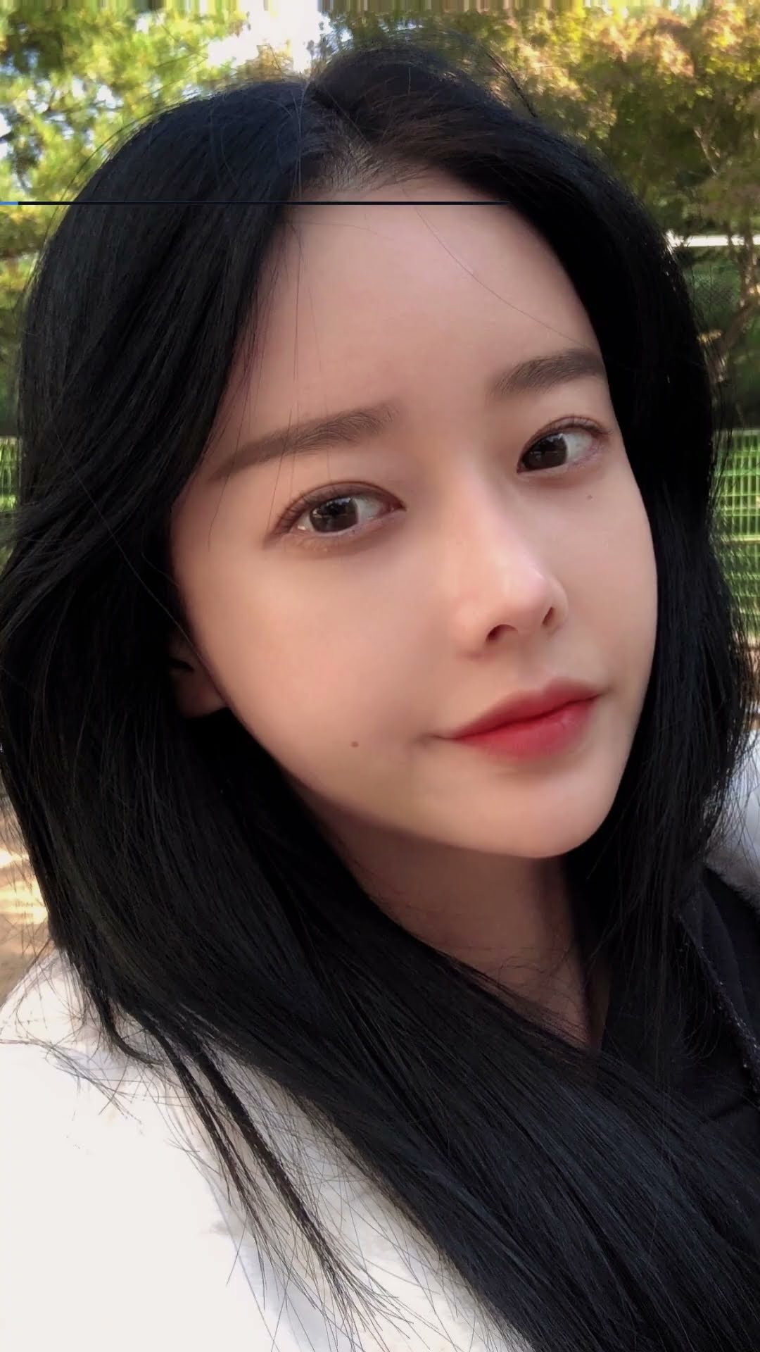 [Short Chin+Mandible Jaw+Cheekbone+rhinoplasty] #abplasticsurgery