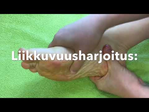 Video: Kuoppia Ison Varpaan Jaloissa - Mikä Se On Ja Miten Sitä Hoidetaan?