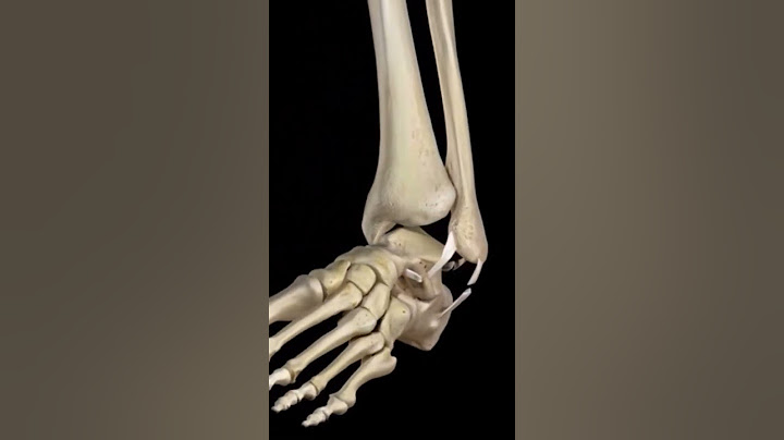 torção de tornozelo, veja o vídeo na íntegra para saber o que fazer! #ortopediaetraumatologia