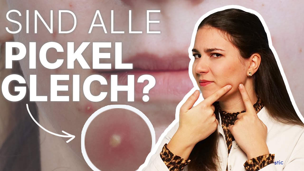 Warum Kommen Pickel Immer An Dergleichen Stelle Pickelarten - Unterirdische Pickel, was steckt dahinter? 🤔 Hautärztin