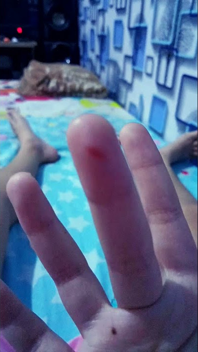 tangan aku berdarah😭