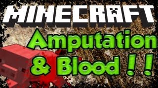 Minecraft Mods - Blood and Amputation