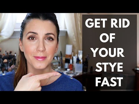 How to Get Rid of a Stye Fast | Josephine Fusco