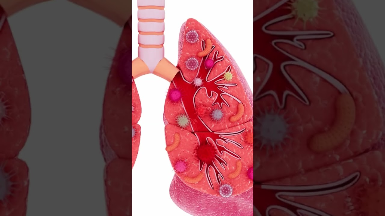 पेट के कैंसर के आखिरी स्टेज के लक्षण  | Symptoms Of Stomach Cancer | Dr. Sumit Shah