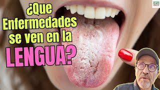 👅🔬WHAT DISEASES CAN BE SEEN ON PEOPLE'S TONGUE?😱 Signs YOU SHOULD KNOW ✅ 👅🔬WHAT DISEASES CAN BE SEEN ON PEOPLE'S TONGUE?😱 Signs YOU SHOULD KNOW ✅