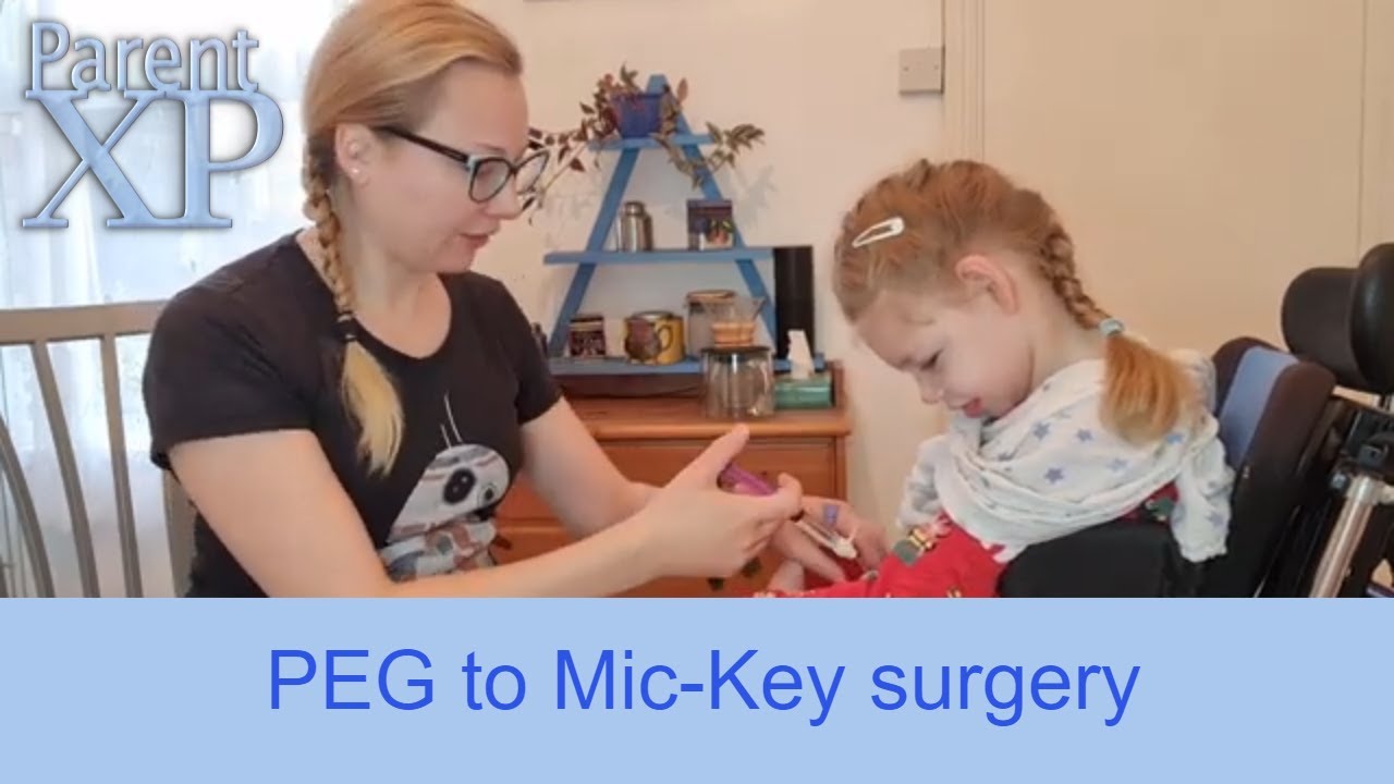 Peg To MicKey surgery needed YouTube