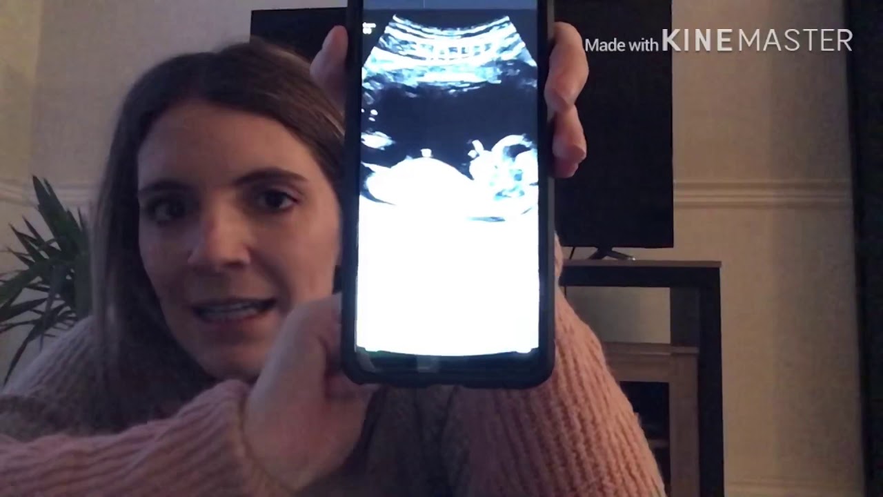 Comment connaître le sexe du bébé - YouTube