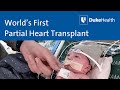 Duke health performs worlds first partial heart transplant  duke health