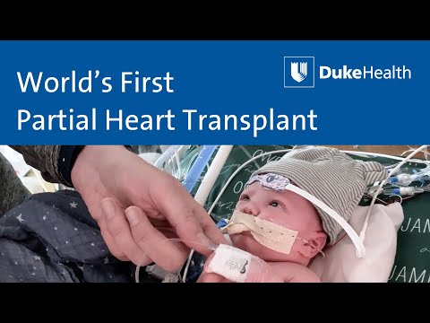 Duke Health Performs World's First Partial Heart Transplant | Duke Health